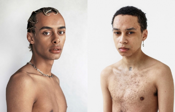 Pieter Hugo's New Portraits Embrace Vulnerability and Frailty